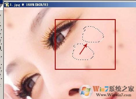 照片的臉上長痘痘怎么調?教你照片臉上長痘痘怎么去除